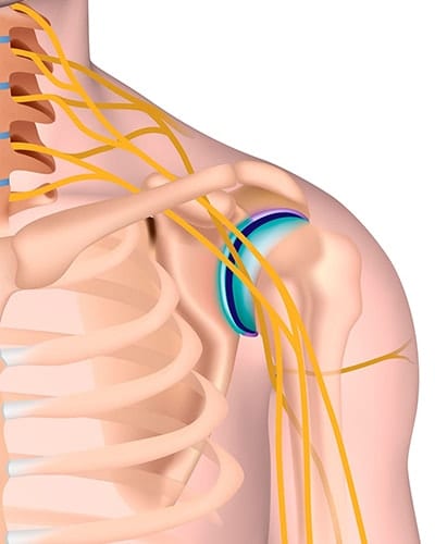 Brachial plexus and peripheral nerve injuries